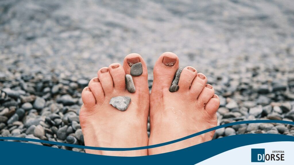 Consejos para cuidar los pies en primavera y verano